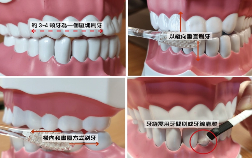 錯誤刷牙的致命傷：破解10大迷思，拯救你的牙齒健康
