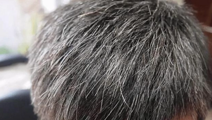 一天長幾根頭髮