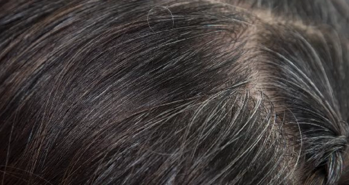 白頭髮髮根黑原因