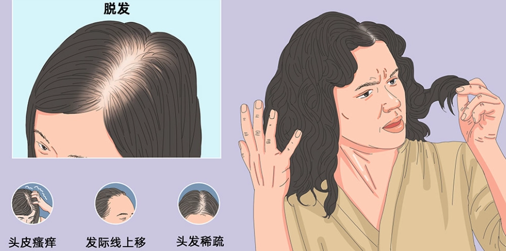 全身毛髮脫落原因