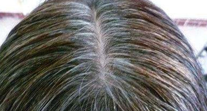 白頭髮如何變黑