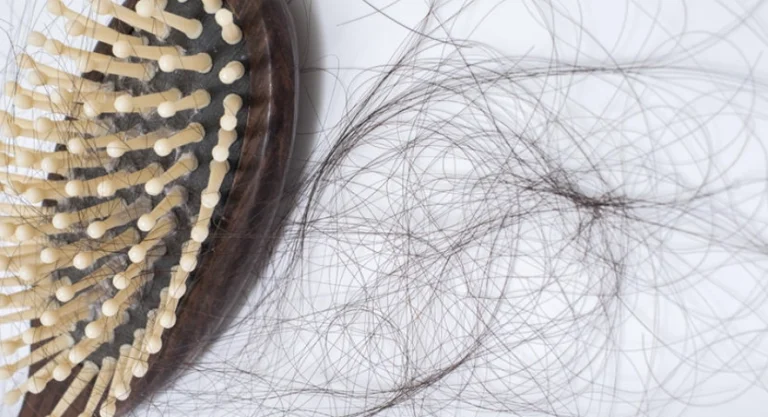 洗澡掉很多頭髮