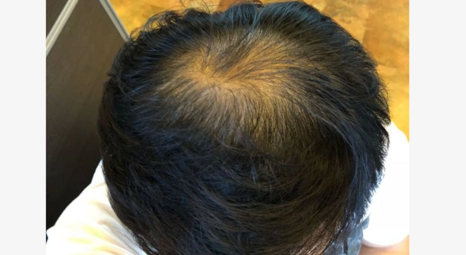 頭髮稀疏髮型男必看！髮型師不說的造型技巧與保養心法