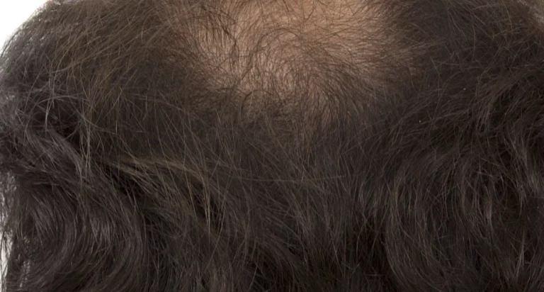 一天會長幾根頭髮