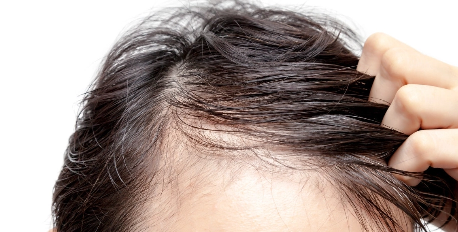 頭髮變細有救嗎？專家解析原因與三大改善對策